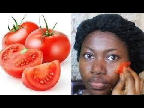 Urunyanya umuti ukomeye wo kwita ku isura yawe//  How to remove acne on your face by using Tomato ?