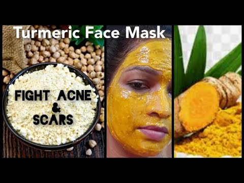 turmeric face mask for hyperpigmentation  | turmeric face mask for acne | turmeric face mask