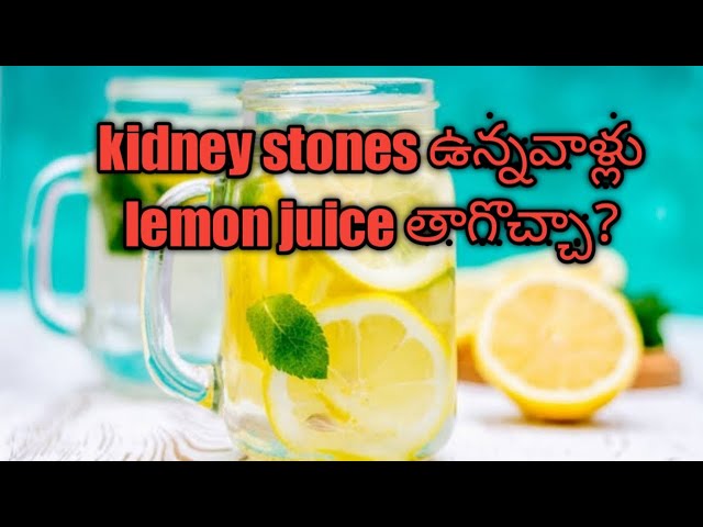 lemon juice benefits and side effects.is it useful for kidney stone patients,