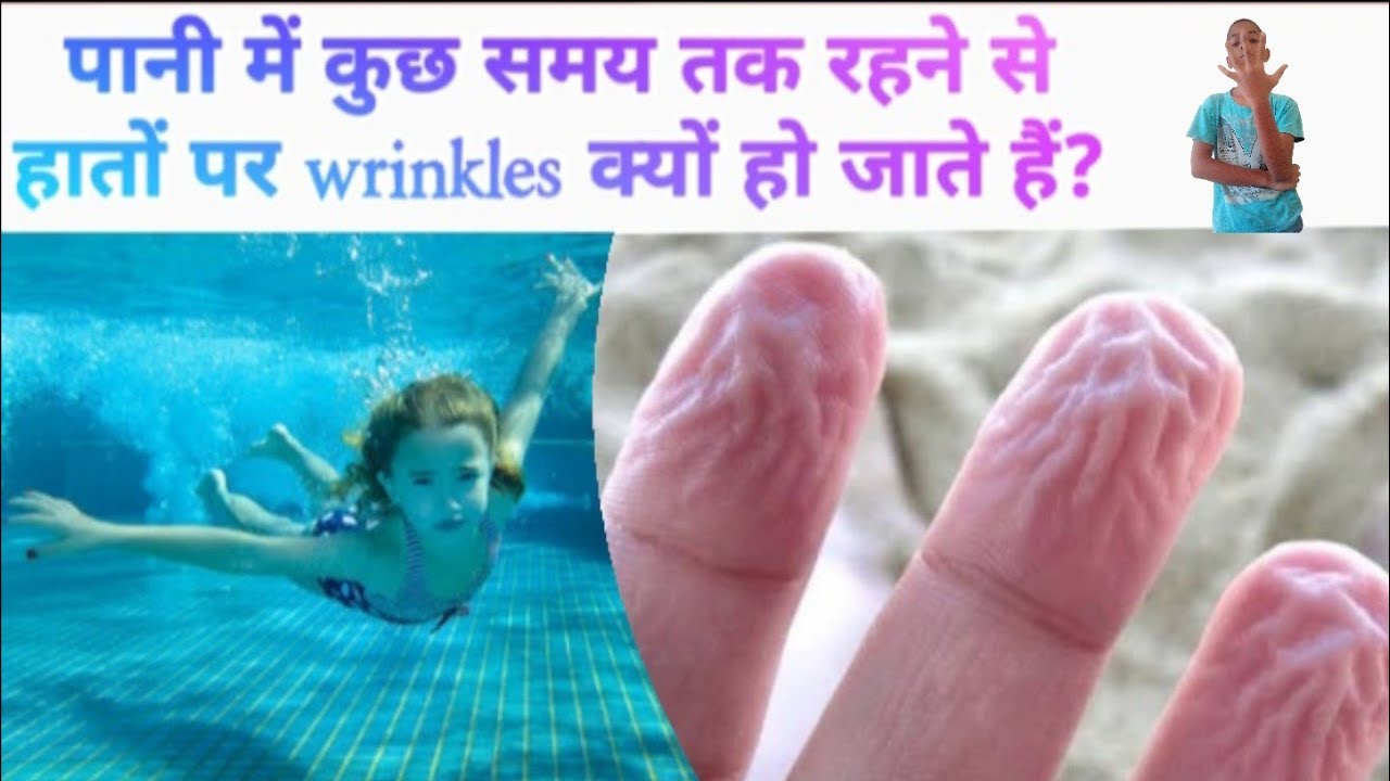 जब हम पानी में कुछ समय तक रहते हैं, तो हमारे Skin में wrinkles क्यों आने लगते हैं | #Shorts