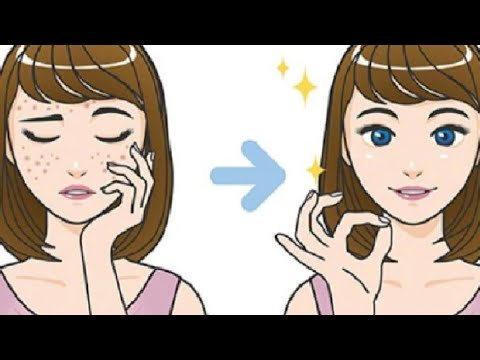 Pimples remove challenge in 7 day's ?????
